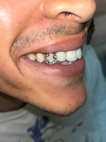 Grills